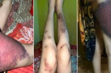 IRT Muda di Bulukumba Mengaku Disiksa Suami hingga Tak Bisa Berdiri Dua Hari