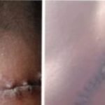 Penganiayaan Sadis, Banyak Pihak Disebut, Status Hukum Tak Jelas