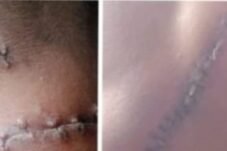 Penganiayaan Sadis, Banyak Pihak Disebut, Status Hukum Tak Jelas