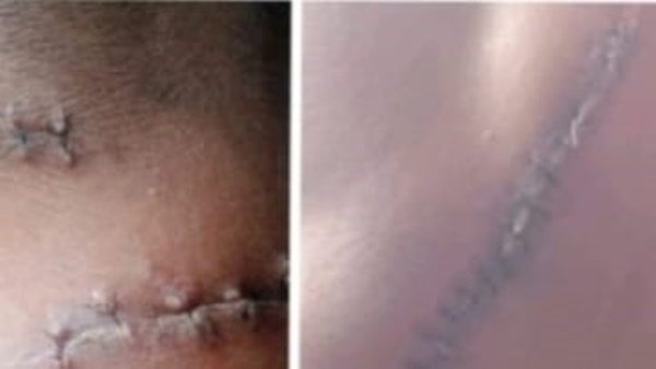 Penganiayaan Sadis, Banyak Pihak Disebut, Status Hukum Tak Jelas